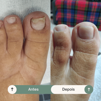 Copia-de-Before-4-1.png